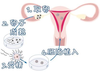 关于孕妈供卵代怀助孕咨询微信群